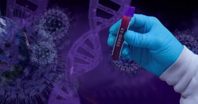 Covid Variante P covid dna