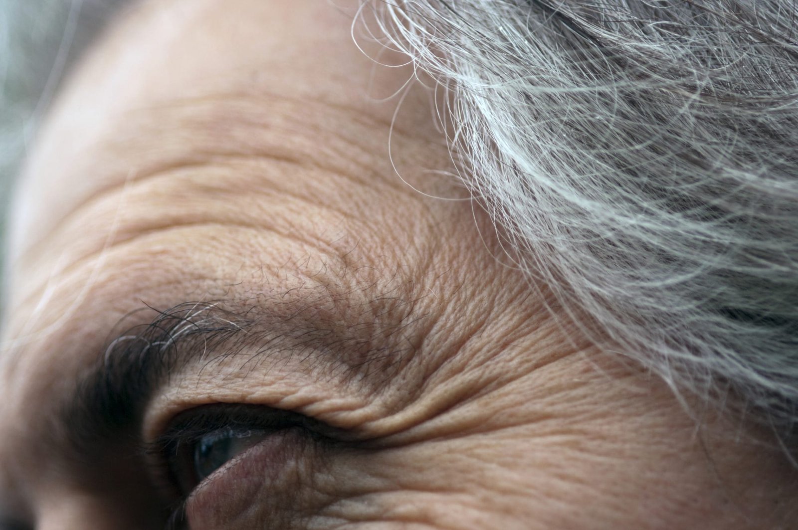 idoso com rugas ao redor dos olhos orig 1