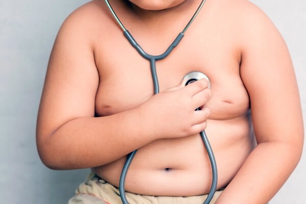 Obesidade infantil: especialistas esclarecem mitos
